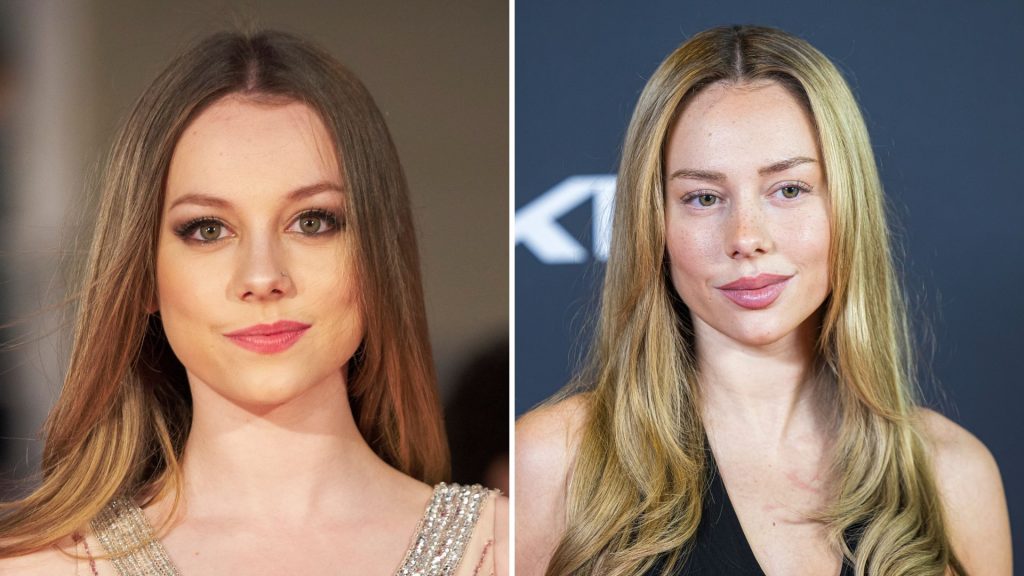 La transformación de Ester Expósito: Antes y después de sus cirugías ...