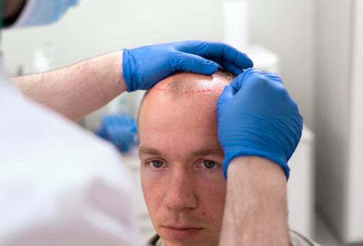 avances médicos de transformación